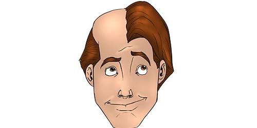 Scientists Find New Hope For Balding Problems