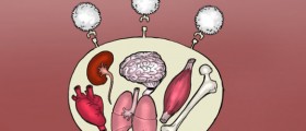 Lupus: When The Immune System Fires Against Its Own Mates