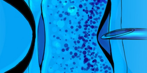 The Potential And Perils Of International Commercial Surrogacy