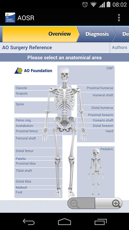 AO Surgery Reference App, a detailed guide on orthopedic fracture ...