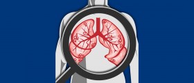 The COPD Pocket Consultant Guide App, mobile guidelines for chronic obstructive pulmonary disease