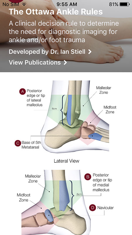 The Ottawa Rules App, a decision support tool to decrease unnecessary ...