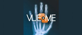 VueMe App, a cloud-based tool for patients to view, store and share their diagnostic medical imaging