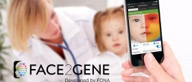 An Interview with FDNA, the Company That Created the 'Face2Gene' App