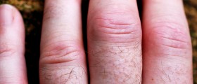 Best Rheumatology Apps for Clinicians and Patients