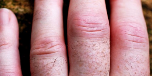 Best Rheumatology Apps for Clinicians and Patients