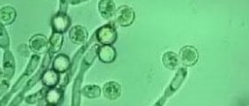 Diagnosed with Candida Infection! What now?