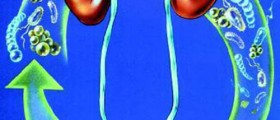 Recurring Urinary Tract Infection