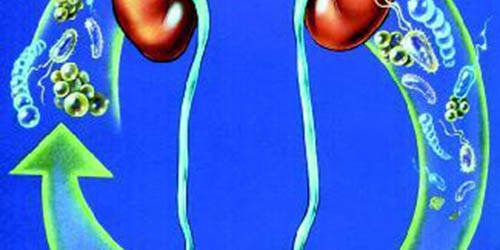 Recurring Urinary Tract Infection