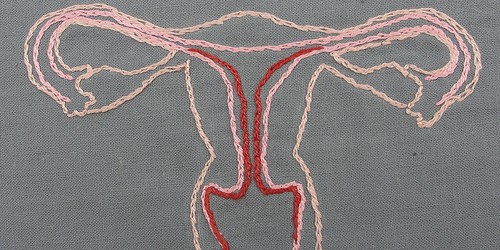 Polycystic Ovary Syndrome (PCOS): How to correct your hormonal imbalance?