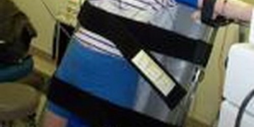 Postural Orthostatic Tachycardia Syndrome (POTS)