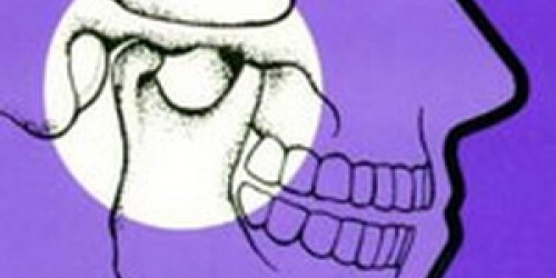 Temporomandibular Joint Syndrome