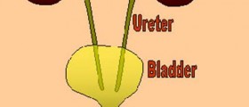 Most common causes of inflamed bladder
