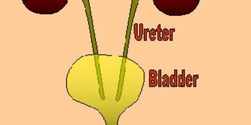 Most common causes of inflamed bladder