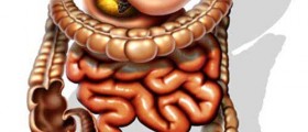 Nutrition in preventing colon cancer