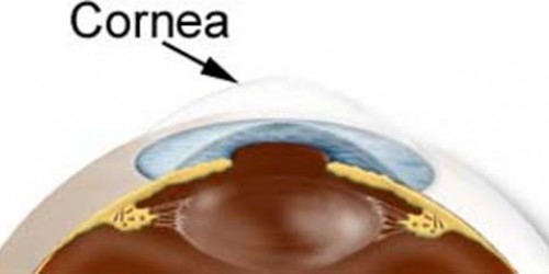 Recurrent Corneal Erosion Fact Sheet
