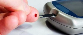 Diabetes type 2 - Causes and Prevention