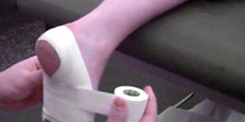 Plantar Fasciitis: Causes, Symptoms & Treatment