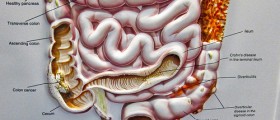 Who should have colonoscopy exam?