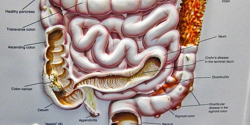 Who should have colonoscopy exam?