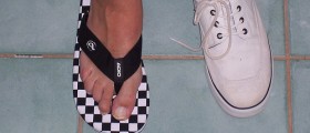Hammer toe surgery