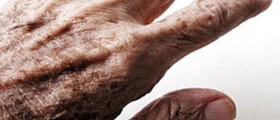 Available medications for Parkinson's Disease!