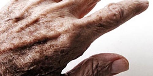 Available medications for Parkinson's Disease!