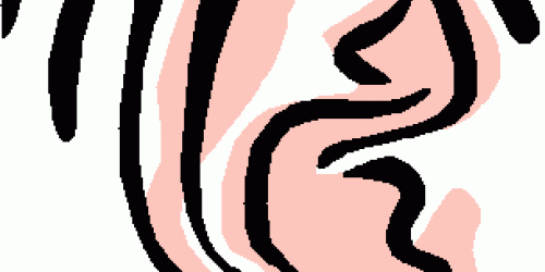 Imbalance and Dizziness caused by Superior Canal Dehiscence Syndrome