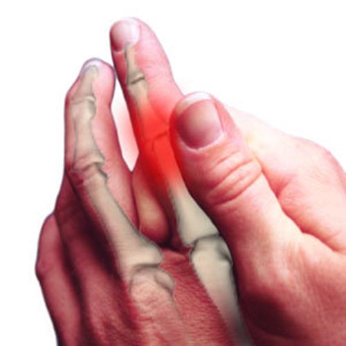 Neuropathy | Nervous System Disorders and Diseases articles | Body