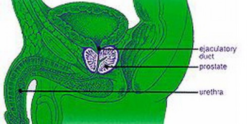 How to treat prostatitis with natural supplements?