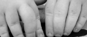 Schizophrenia and Autism