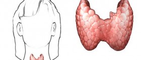 Hypothyroidism and the weight battle