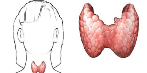 Hypothyroidism and the weight battle
