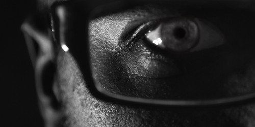 Hereditary Hemochromatosis: You Can Have Too Much Iron!?