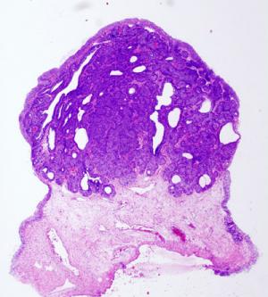 A guide to gall bladder diseases