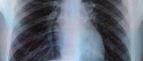 About acute breathlessness