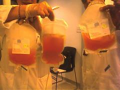 About acute cytomegalovirus
