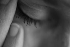 About chronic cephalgia