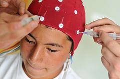 About concussion treatment