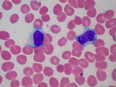 About high lymphocytes