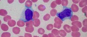 About high lymphocytes
