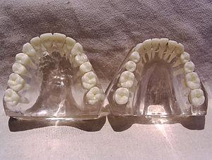 About wisdom tooth extraction