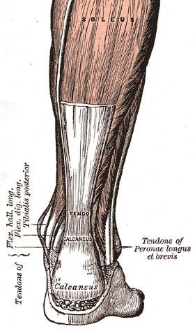 Achilles tendon injury