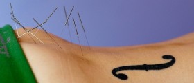 The Science Behind Medical Acupuncture