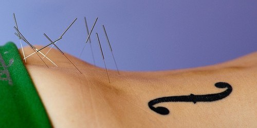 The Science Behind Medical Acupuncture