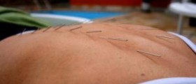 Acupuncture as a viable weight loss option