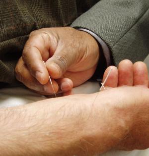 Acupuncture for back pain