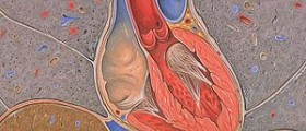 Acute coronary syndrome treatment