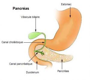 cause of acute hemorrhagic pancreatitis