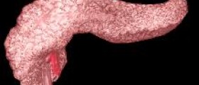 Acute pancreatitis symptoms